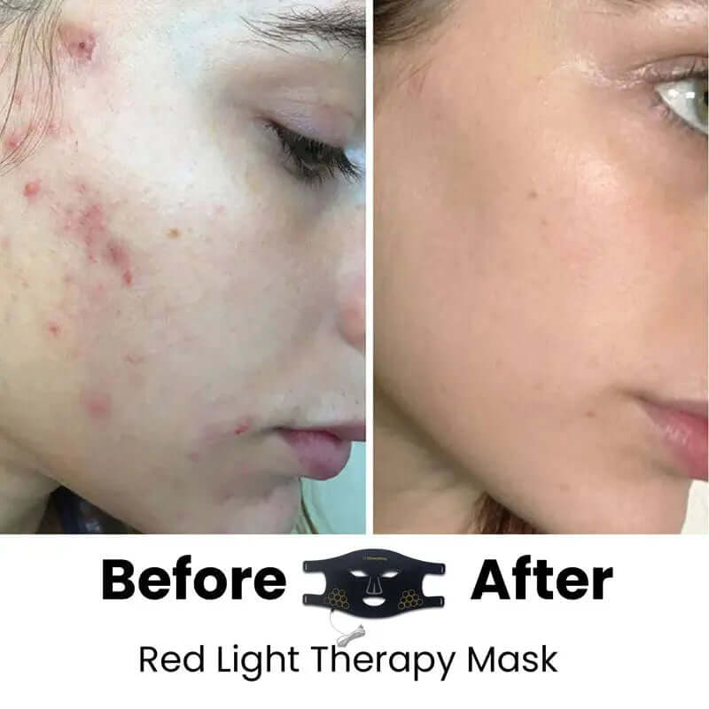 red light mask
