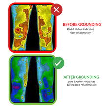 Load image into Gallery viewer, Theramal Images Before &amp; after earthing reduction in Inflammation
